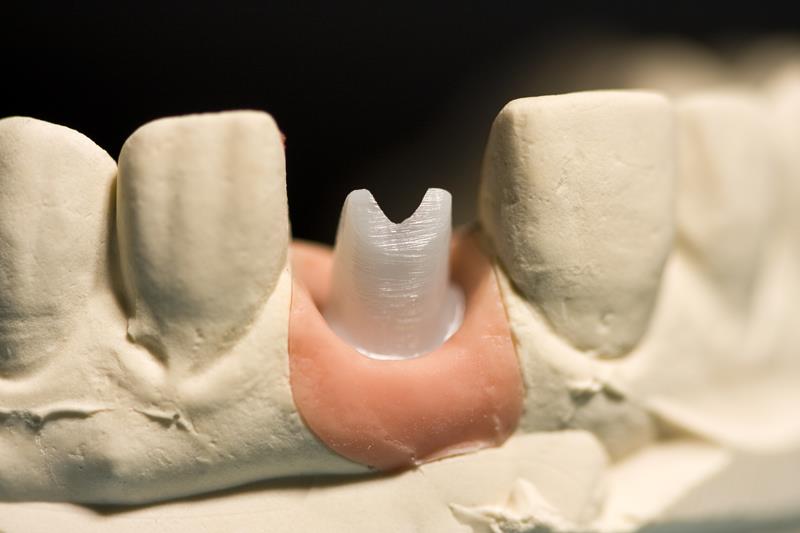 Implant Restoration 6500 Jericho Turnpike, Suite 2W<Br>Syosset, NY 11791